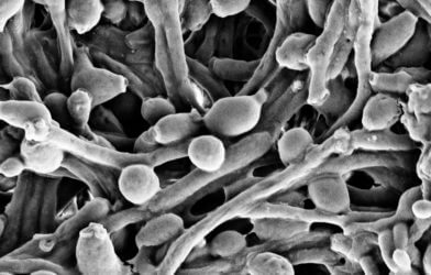 C-albicans fungus