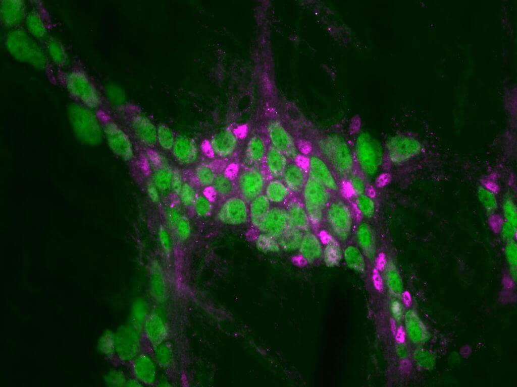 Enteric neurons & glial cells