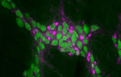 Enteric neurons & glial cells