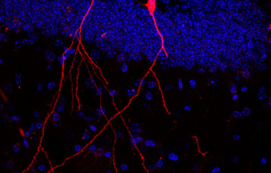 Intestinal bacteria study