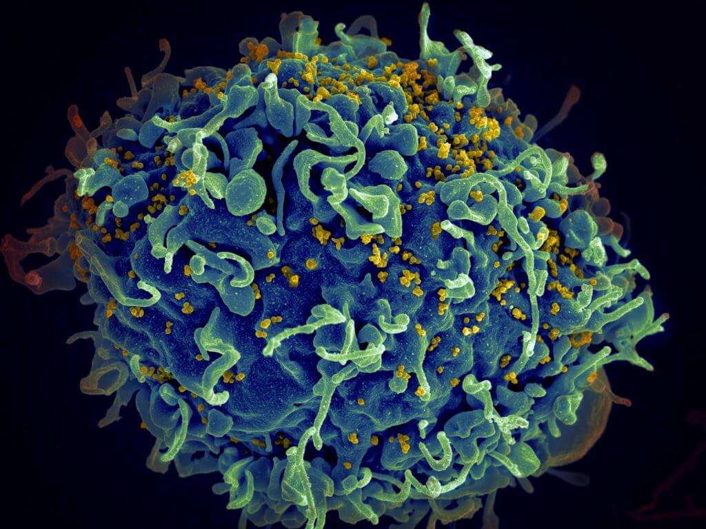 HIV/AIDS