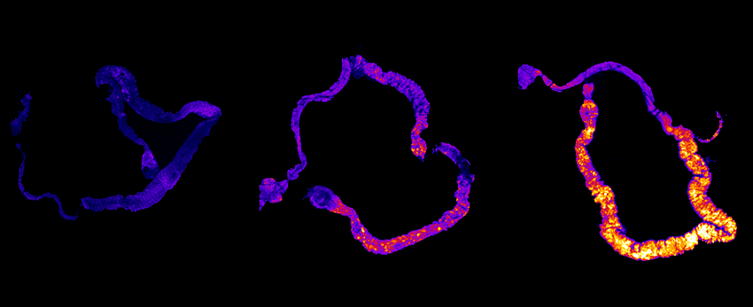 Sleep deprivation / gut study