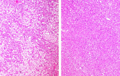 Experimental cancer treatment
