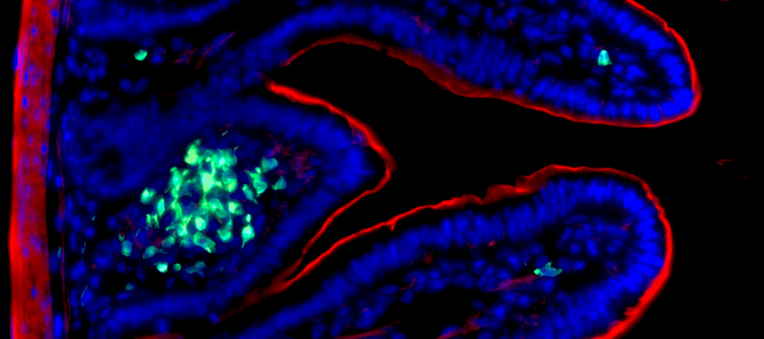 Intestinal ILC3s