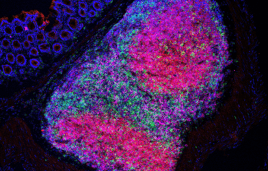 Tertiary lymphoid structures