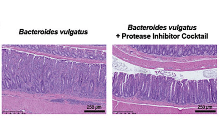 Bacteroides vulgatus