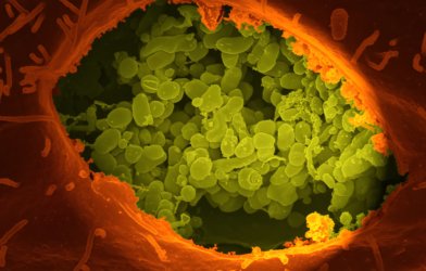 Coxiella burnetii - bacteria causing Q fever