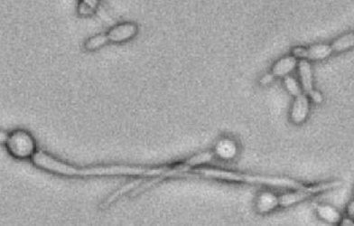 C. albicans fungi