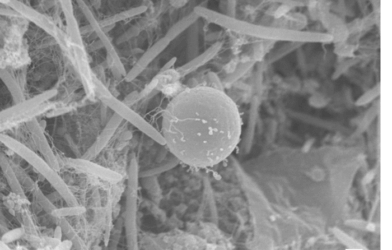 Blastocystis ST4 cell