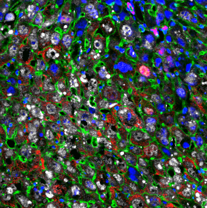 Liver cells