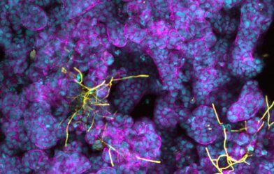 Candida albicans yeast