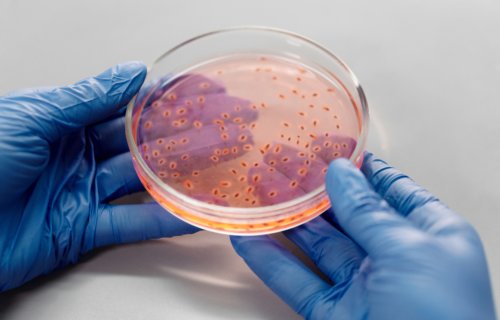 Bacteria in a Petri dish