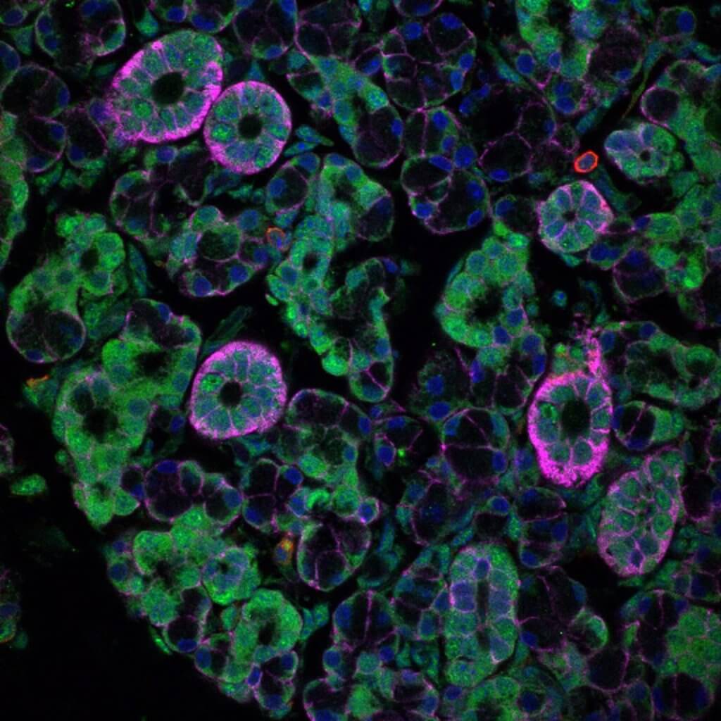 Epithelial cells