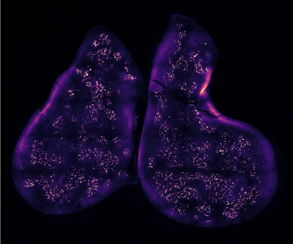 Thymus gland