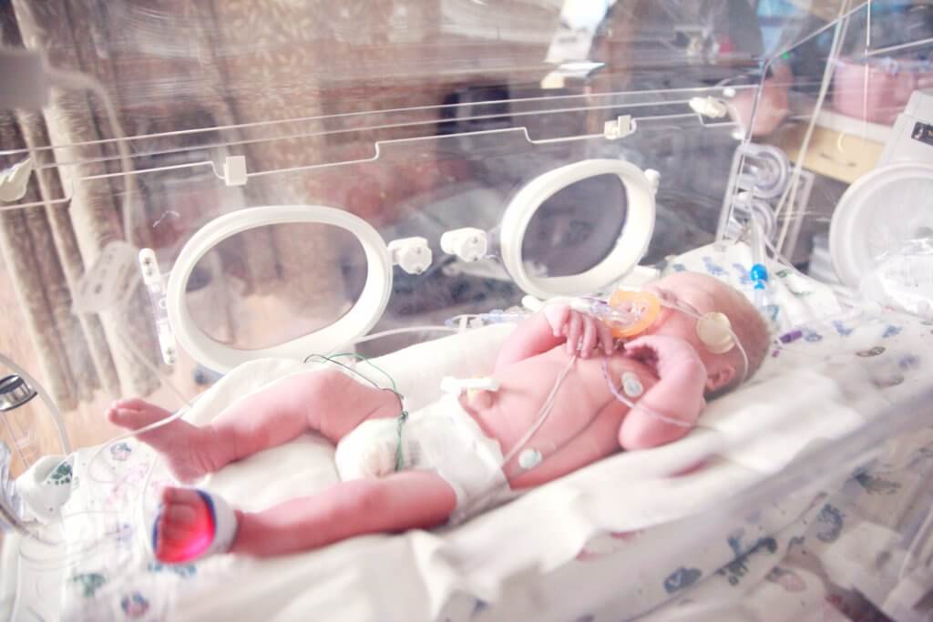 Is breast milk better for gut health of premature babies than formula?